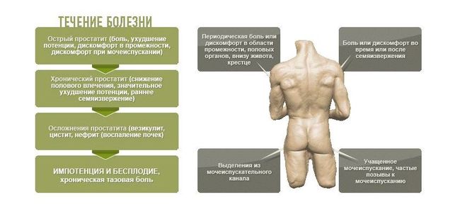 Простатит у мужчин бывает хронический и острый.