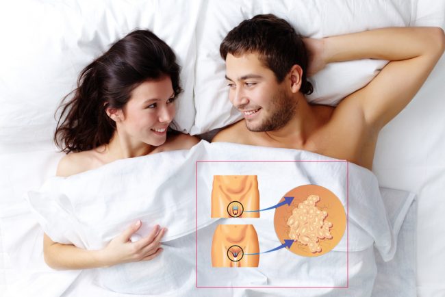 Женщина должна насторожиться, если у нее появились беловатые с небольшой примесью крови выделения из влагалища. Чем крупнее опухоль и чем дольше она существует, тем больше вероятность, что возникнут кровянистые выделения из влагалища после полового акта