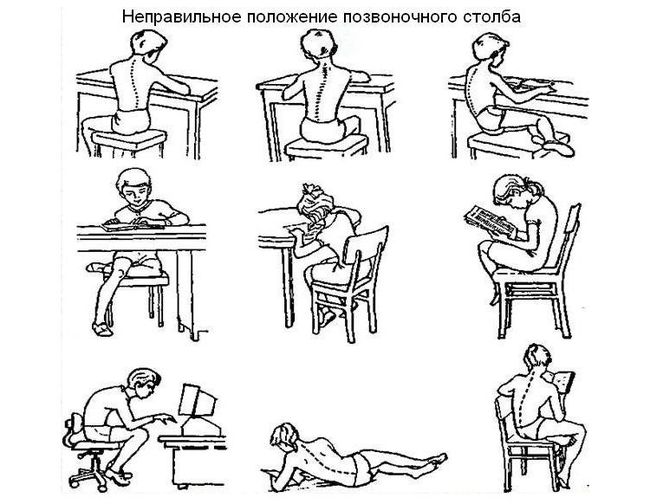 Сколиоз у детей образует из-за простых ошибок - неправильного положения позвоночного столба во время учебы и отдыха