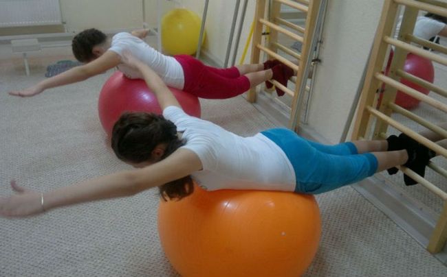 Лечебная гимнастика - один из методов лечения сколиоза