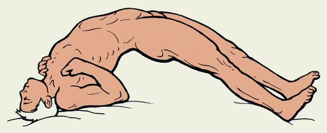 Столбняк - тяжелейшее инфекционное заболевание поражающее нервную систему, может привести к необратимым осложнениям в организме, вплоть до смерти