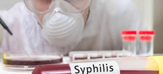 С помощью анализа крови из вены доктор может подтвердить подозрения на сифилис у больного и поставить точный диагноз