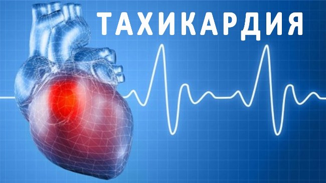 Тахикардия - нарушение частоты сердечных сокращений, которое характеризуется учащением сердечного ритма