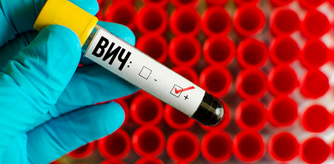 Зачастую ВИЧ-инфекцию диагностируют только на стадии вторичных проявлений, когда симптомы становятся более выраженными и очевидными