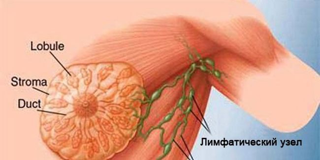 На фото показано расположение лимфатического узла под мышкой у женщины и как он связан с грудью.