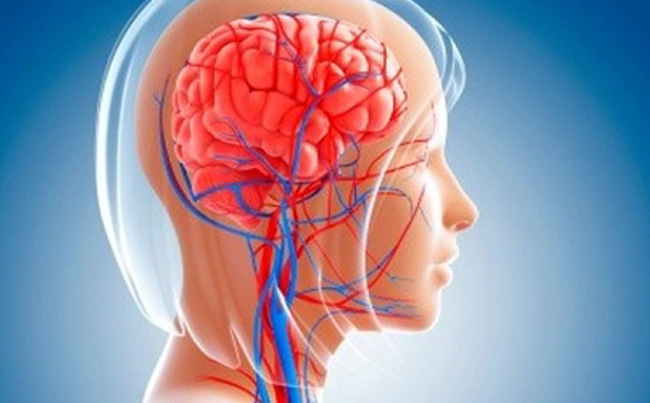 При остром нарушении кровоснабжения в головном мозге назначают уколы Мексидол