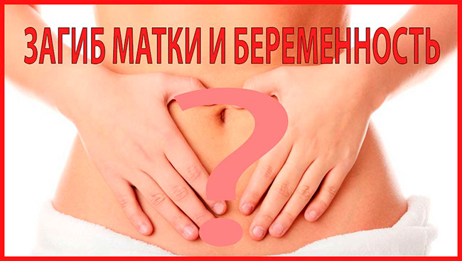 При физиологическом загибе матки, который обычно не сильно выражен, беременность и вынашивание ребенка протекает спокойно и без каких-либо осложнений